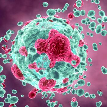 urothelial carcinoma