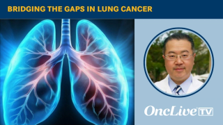 Jay M. Lee, MD, surgical director of the Thoracic Oncology Program, and professor of surgery at the David Geffen School of Medicine at UCLA