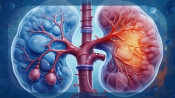 Renal Cell Carcinoma | Image Credit: © Ashling Wahner & MJH Life Sciences Using AI