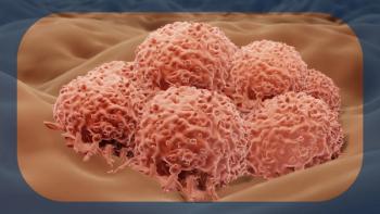 Advanced Melanoma | Image credit: © Artur - stock.adobe.com