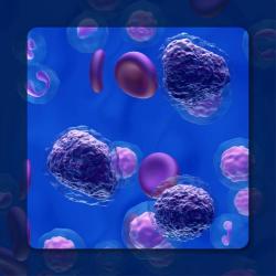 Liso-Cel Receives European Approval in Relapsed/Refractory Follicular Lymphoma