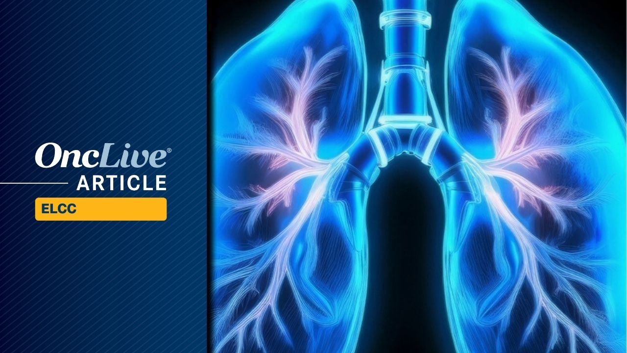 Serplulimab Plus Iza-Bren in ES-SCLC | Image Credit: © Image by Ashling Wahner & MJH Life Sciences Using AI