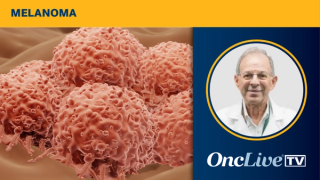 Mario Sznol, MD, Sylvester Comprehensive Cancer Center