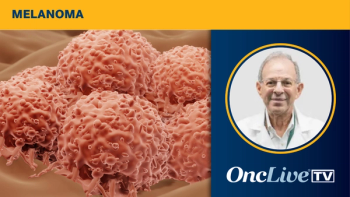 Mario Sznol, MD, Sylvester Comprehensive Cancer Center