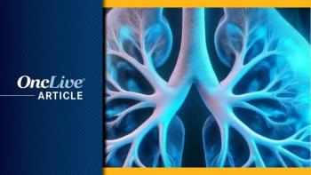 Durvalumab Plus Concurrent Chemoradiotherapy in NSCLC | Image Credit: © Ashling Wahner & MJH Life Sciences Using AI