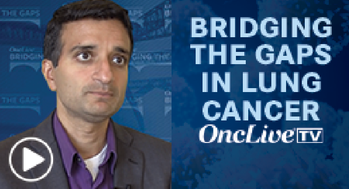 Dr Patel on Establishing a Consensus for Lung Cancer Treatment - Vimarsana News