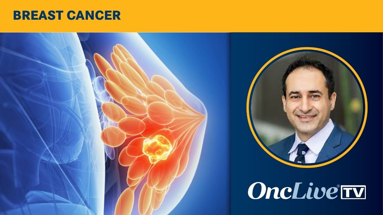Cardiac Toxicities Associated With Breast Cancer Therapies | Image Credit: © Sebastian Kaulitzki - stock.adobe.com