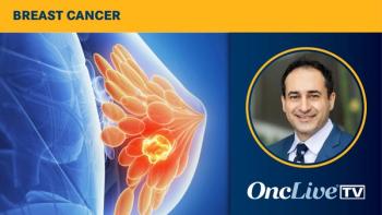 Cardiac Toxicities Associated With Breast Cancer Therapies | Image Credit: © Sebastian Kaulitzki - stock.adobe.com