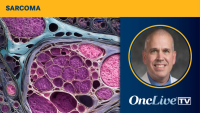 Richard F. Riedel, MD, discusses the diagnosis of PEComa and referral/treatment planning following diagnosis.