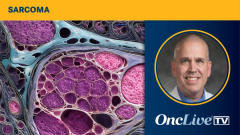 Richard F. Riedel, MD, discusses the diagnosis of PEComa and referral/treatment planning following diagnosis.