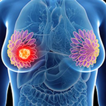 Breast Cancer Image