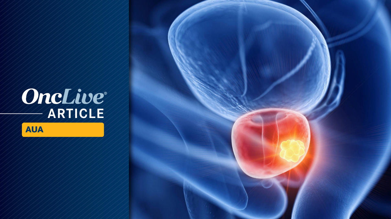<![CDATA[Enzalutamide Plus Leuprolide Yields Prolonged Treatment Suspension in Biochemically Recurrent Prostate Cancer]]>