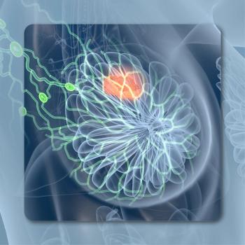 Breast Cancer | Image Credit: © Axel Kock – stock.adobe.com