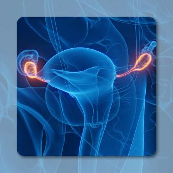 Platinum-Resistant Ovarian Cancer | Image credit: © Sebastian Kaulitzki - stock.adobe.com