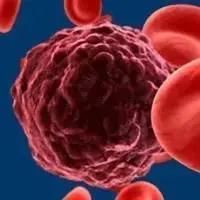 Chronic Lymphocytic Leukemia