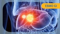 Nivolumab/Ipilimumab Maintains OS, ORR Benefits in Chinese Patients With Unresectable HCC