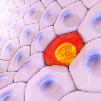 Mohammed Milhem, MBBS, Holden Comprehensive Cancer Center, University of Iowa Health Care