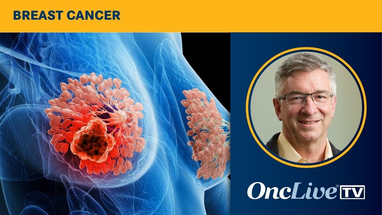 Treatment Sequencing With ADCs in Breast Cancer | Image Credit: © Sebastian Kaulitzki - stock.adobe.com