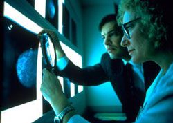 Tamoxifen a common drug used to treat breast cancer