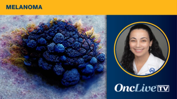 Zeynep Eroglu, MD, of Moffitt Cancer Center