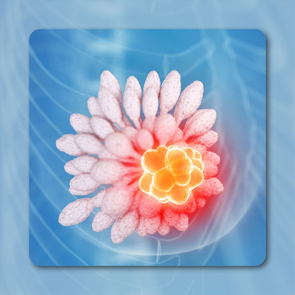 PD-L1+ TNBC | Image Credit: ©  Sebastian Kaulitzki – stock.adobe.com