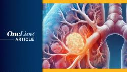 Targeted Therapies Drive Demand for Comprehensive Biomarker Testing in NSCLC