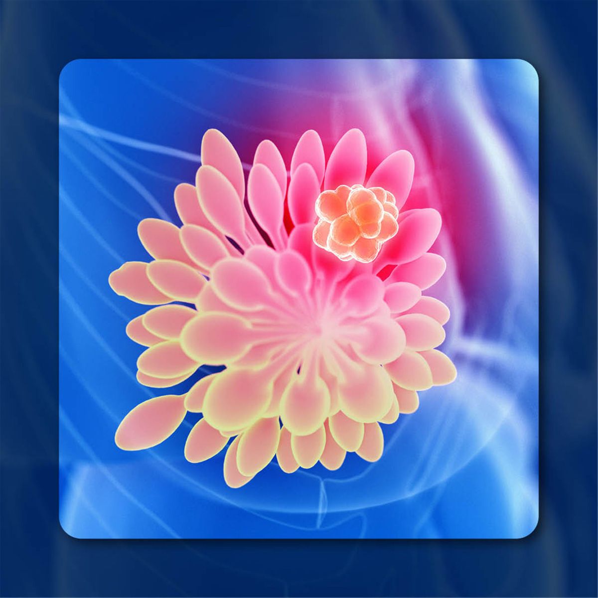 Abemaciclib in High-Risk Early Breast Cancer | Image Credit: © Sebastian Kaulitzki - stock.adobe.com