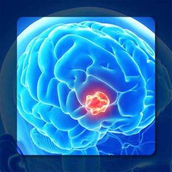 Glioblastoma |Image Credit: ©   Sebastian Kaulitzki - stock.adobe.com