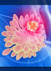 Breast Cancer | stock.adobe.com