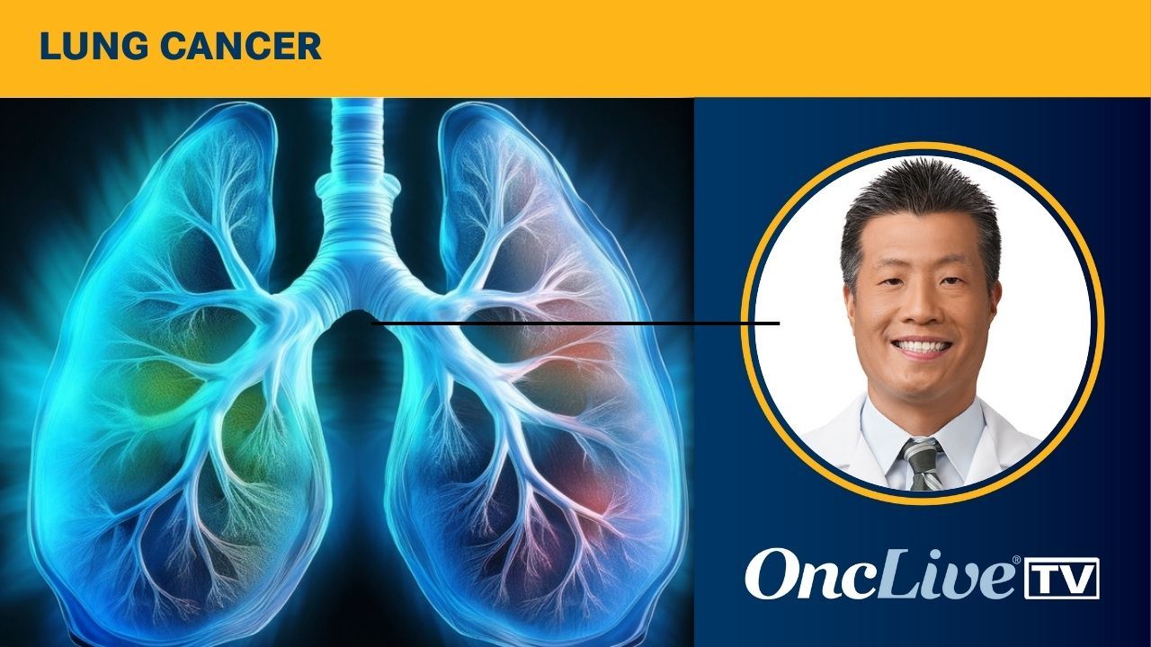 SABR in Non–Small Cell Lung Cancer Management | Image by Ashling Wahner & MJH Life Sciences Using AI