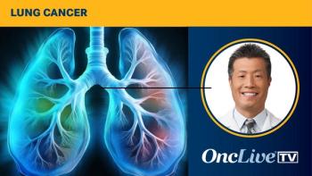 SABR in Non–Small Cell Lung Cancer Management | Image by Ashling Wahner & MJH Life Sciences Using AI