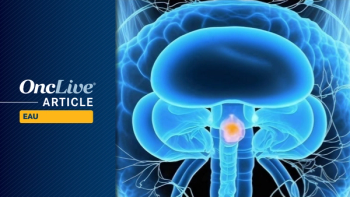 FGFR-Altered NMIBC | Image Credit: © Adin - stock.adobe.com