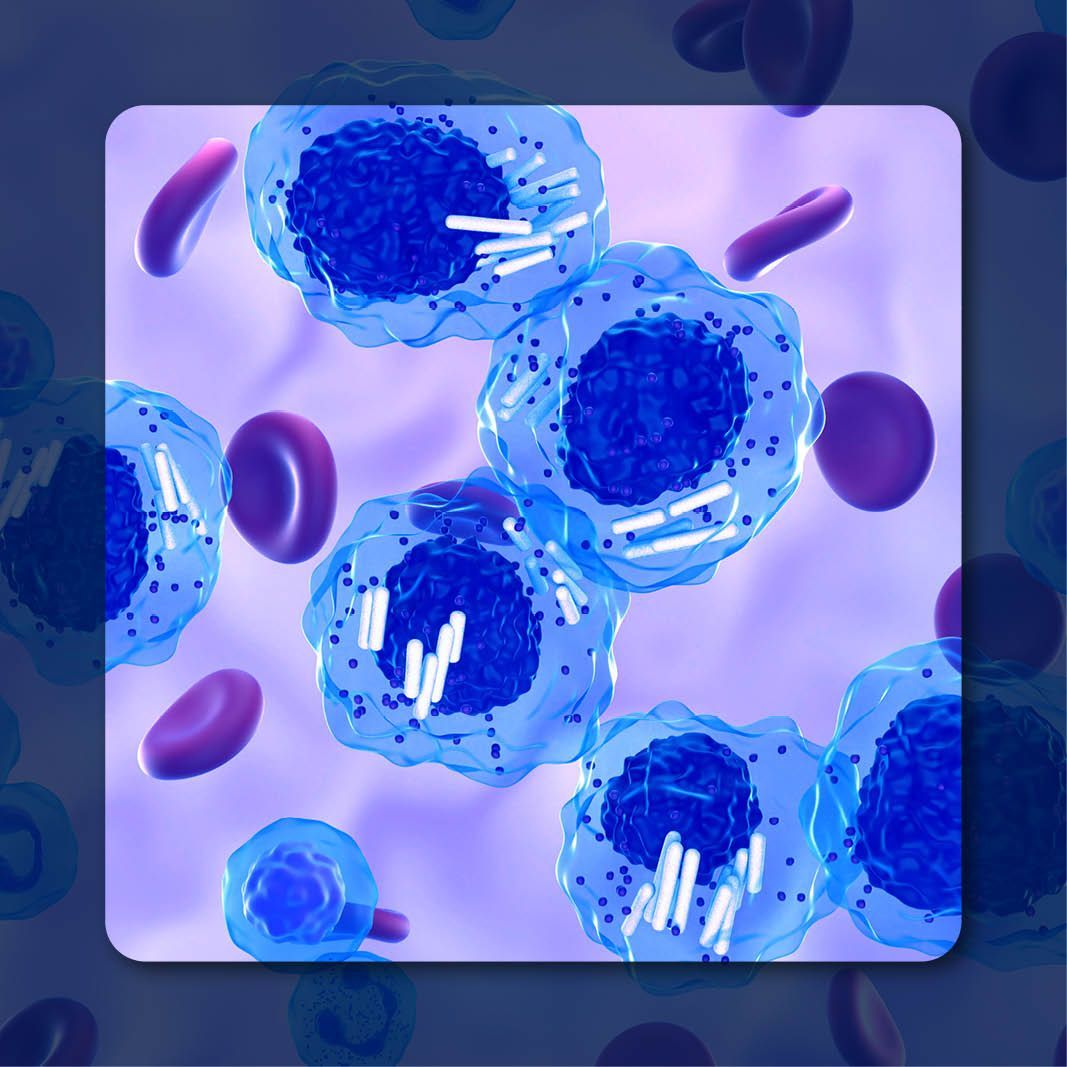 Chronic Lymphocytic Leukemia | Image Credit: © LASZLO– stock.adobe.com