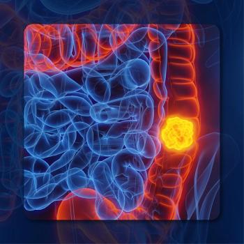 Colorectal Cancer | Image Credit: © Sebastian Kaulitzki – stock.adobe.com