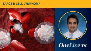 Saurabh Dahiya, MD, FACP, associate professor, medicine, Stanford University School of Medicine; clinical director, Cancer Cell Therapy, Division of Blood and Marrow Transplantation and Cell Therapy, Stanford Medicine