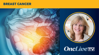Laura J. Esserman, MD, MBA, discusses the potential utility of risk-based screening for breast cancer.