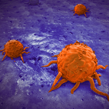 Karl Lewis, MD, of the Colorado School of Medicine