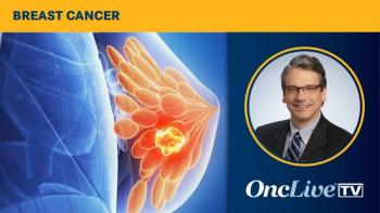 Breast cancer | Image Credit: © Sebastian Kaulitzki - stock.adobe.com