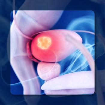 Disitamab Vedotin/BCG in NMIBC | Image Credit:  © Sebastian Kaulitzki – stock.adobe.com