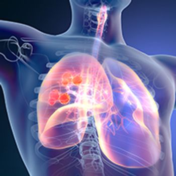 Non-small cell lung cancer