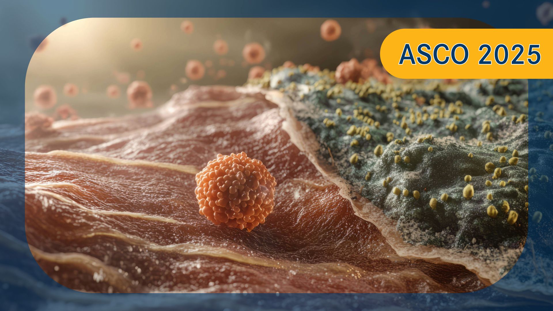 High-Risk Resectable Melanoma | Image credit: © Galina - stock.adobe.com
