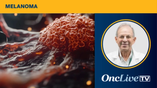 Mario Sznol, MD, Sylvester Comprehensive Cancer Center
