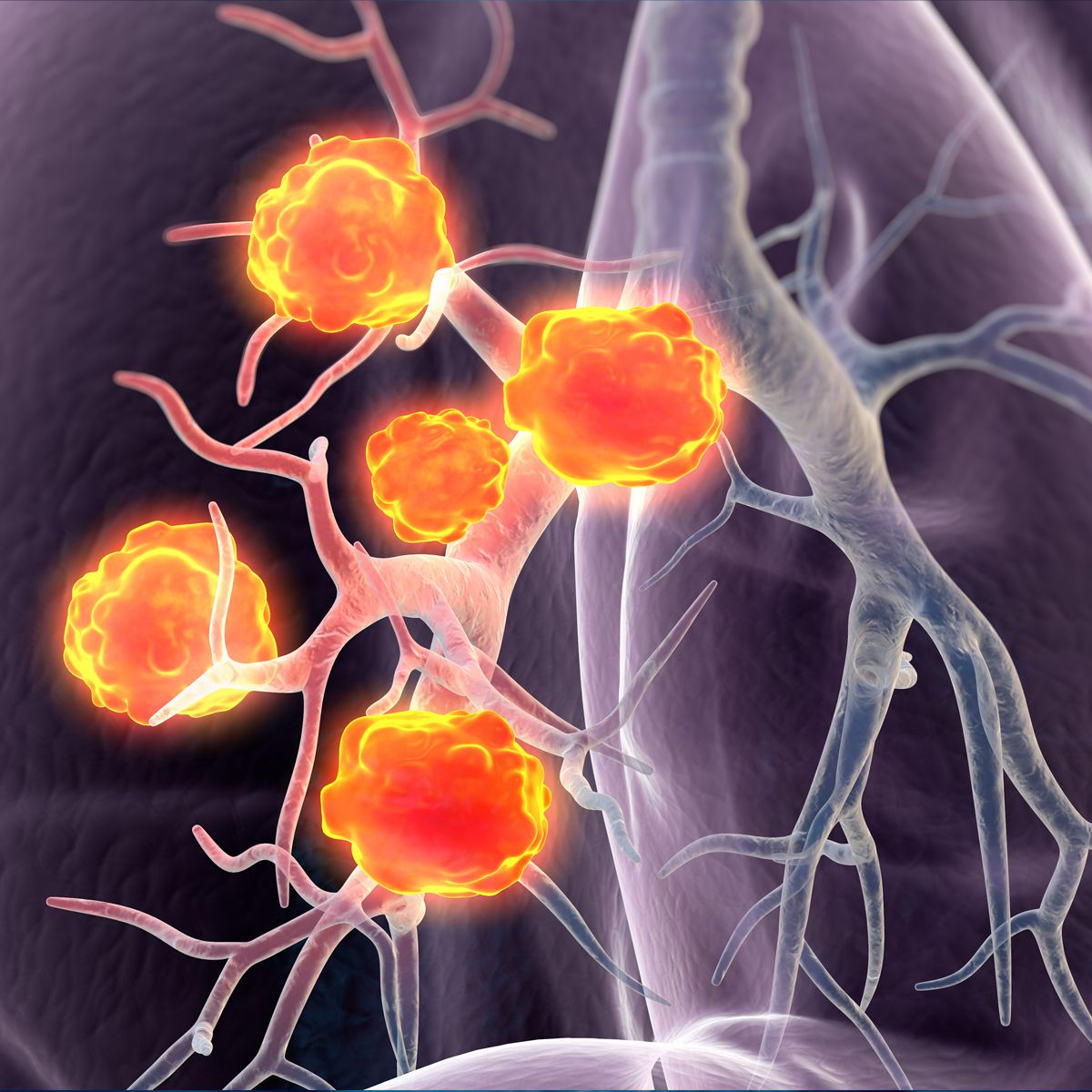 DLL3Directed BiTE, AMG 757 Shows Early Tolerability and