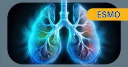Poll: Vote on the Top Lung, GU Cancer Abstracts to Watch at ESMO 2025