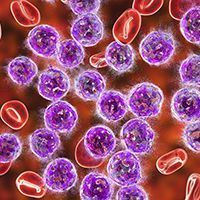 Acute Lymphoblastic Leukemia