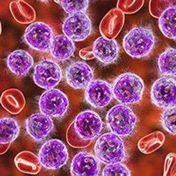 Acute Lymphoblastic Leukemia