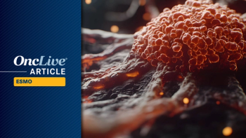 Adjuvant Nivolumab in Resected Melanoma | Image Credit: © Pter - stock.adobe.com