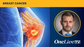 Breast Cancer | Image Credit: © Sebastian Kaulitzki - stock.adobe.com