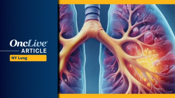 ADCs in NSCLC | Image Credit:   © Ashling Wahner & MJH Life Sciences Using AI