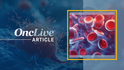 Retrospective Analysis Identifies Pattern of Resistance to First-Line TKIs in Ph+ ALL 